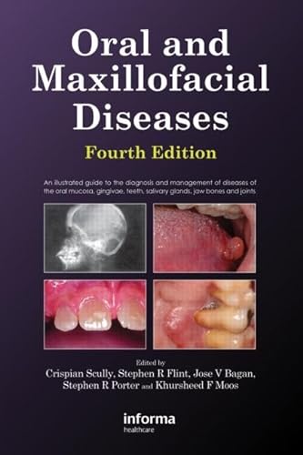 Oral and Maxillofacial Diseases: An Illustrated Guide to the Diagnosis and Management of Diseases of the Oral Mucosa, Gingivae, Teeth, Salivary Glands, Jaw Bones and Joints